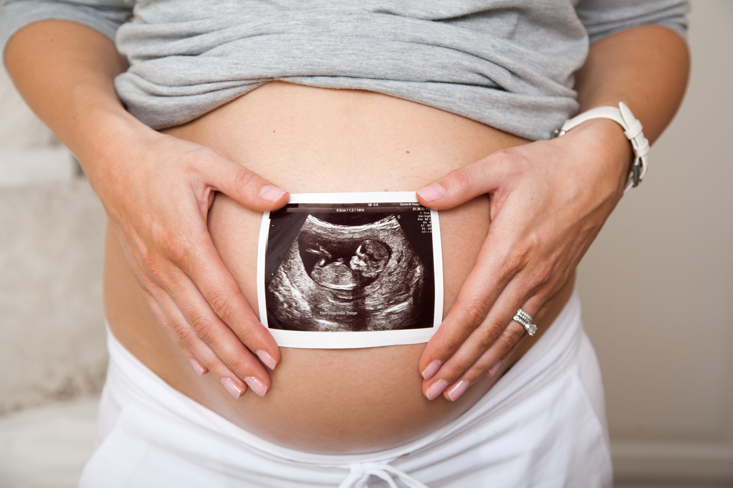 Mujer embarazada sujeta una ecografía
